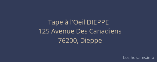 Tape à l'Oeil DIEPPE